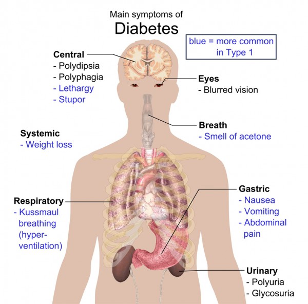 Symptoms of Diabetes-pictograph